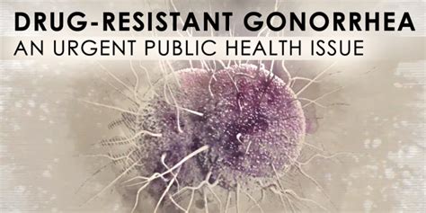 Drug-Resistant Gonorrhea: An Urgent Public Health Issue | National ...