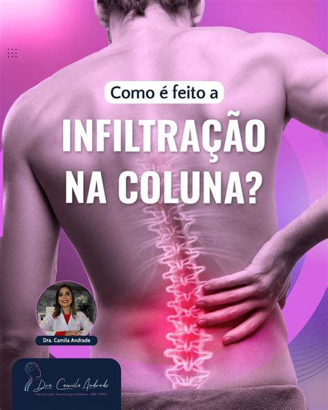 Como é feito infiltração na coluna Dra Camila Neuro