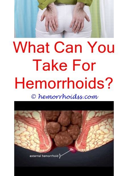 How To Stop Itching Internal Hemorrhoids Can Hemorrhoids Cause Narrow Bowel Movementshow Long