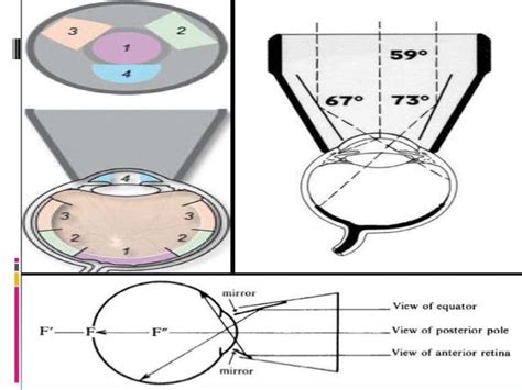 Gonioscopy Gonioscopic Lenses Principle And Clinical Aspects