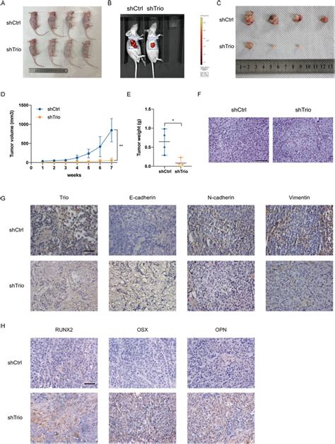 Trio Knockdown Suppress Tumor Growth In Vivo A B After 7 Weeks The