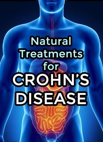 Crohns Disease Natural Treatments Sănătate