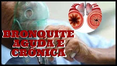 ENTENDA O QUE É BRONQUITE AGUDA E CRÔNICA YouTube