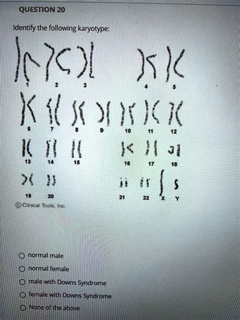 Solved Question Identify The Following Karyotype Inch Klsyw