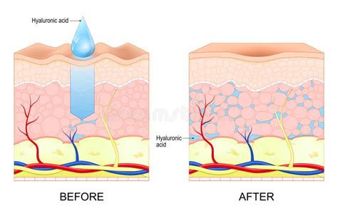 Hyaluronic Acid Skin Rejuvenation Stock Vector Illustration Of