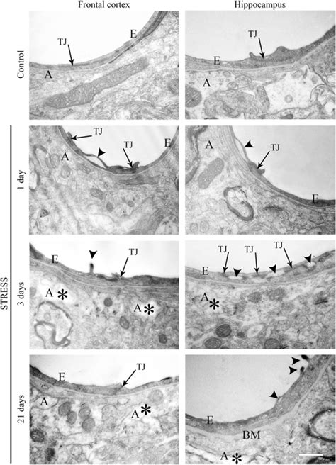 Electron micrographs of brain capillaries in the frontal cortex and ...