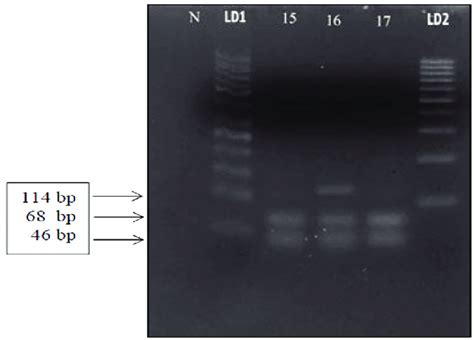 Detection Of FLT3 TKD D835 Gene Mutation By PCR LD1 DNA Ladder 50