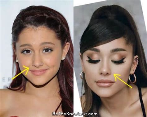 Ariana Grande Plastic Surgery Comparison Photos