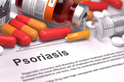 Methotrexate well tolerated, effective for psoriasis - Retail Brief Africa