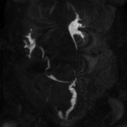 Radiology Quiz Radiopaedia Org