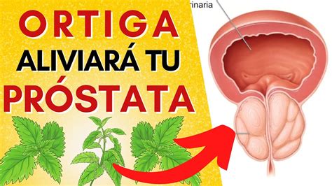 10 BENEFICIOS INCREÍBLES DE LA ORTIGA Alivia la PRÓSTATA INFLAMADA