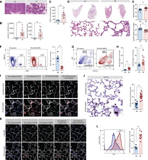 Lung Damage In A Mouse Model Of Severe Acute Pancreatitis A H E