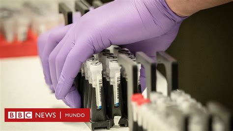 Test De Coronavirus Los Científicos Que Crearon Una Prueba De