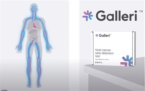 What Is The Galleri Multi Cancer Early Detection Test Virtuosa GYN