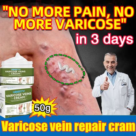 Varicose Vein Treatment Cream Spider Vein Pain Varicosity Effective