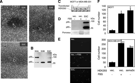 Effect Of Different Class Semaphorins On Cell Migration A Huvecs