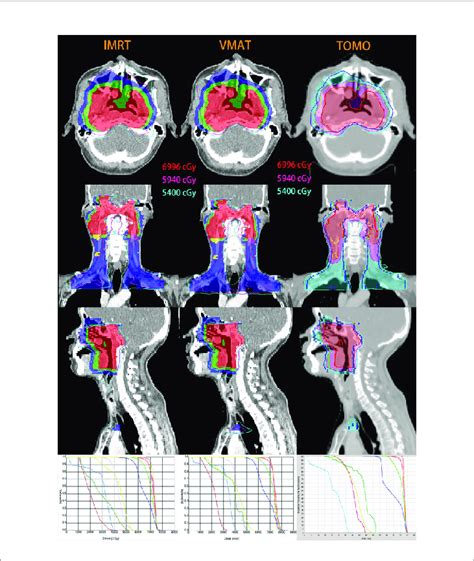 Isodose Distributions And Dose Volume Histograms Dvhs For A