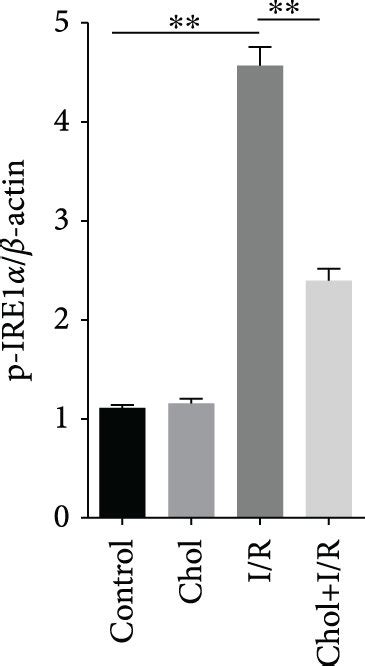 Pretreatment With Cholecalciferol Alleviates Renal Er Stress During