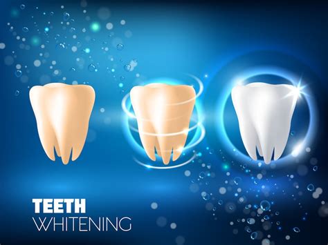 Premium Vector Teeth Whitening Ad Vector Realistic Illustration