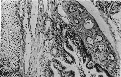 Rete Testis Lacunae And Sections Of Seminiferous Tubules S In The