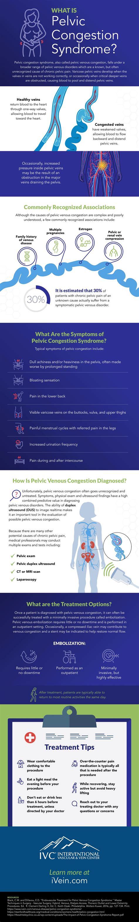 Pelvic Congestion Syndrome Treatment Ivc