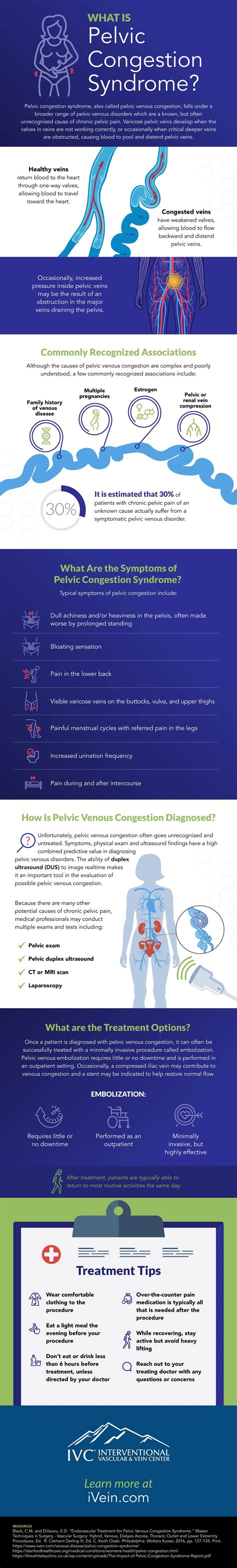 Pelvic Congestion Syndrome Treatment | IVC