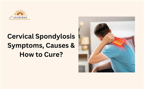 Cervical Spondylosis Symptoms Causes How To Cure