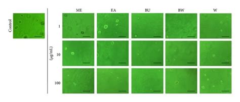 Growth Inhibitory Effects Of Extracts Of P Lutea Leaves Sas Cells