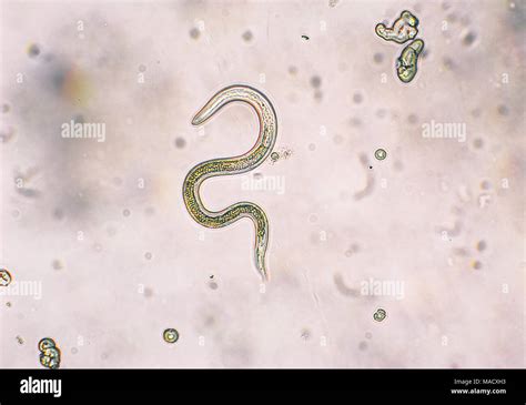 Roundworm Life Cycle In Humans