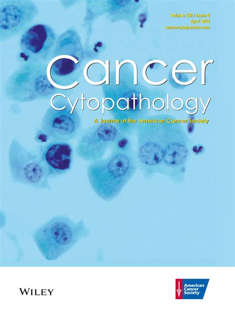 Cytologic Criteria For Well Differentiated Adenocarcinoma Of The