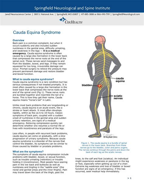 PDF Overview D2uko0fg0ksrq5 Cloudfront Net Cauda Equina Syndrome