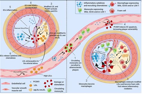 Frontiers PCSK9 Functions In Atherosclerosis Are Not Limited To