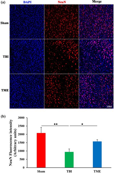 Hif Participates In Secondary Brain Injury Through Regulating