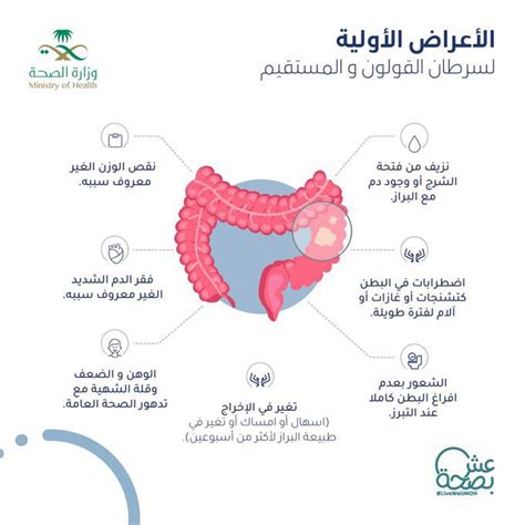 الكشف عن 7 أعراض مبكرة لثاني أكثر سرطان انتشاراً بالمملكة