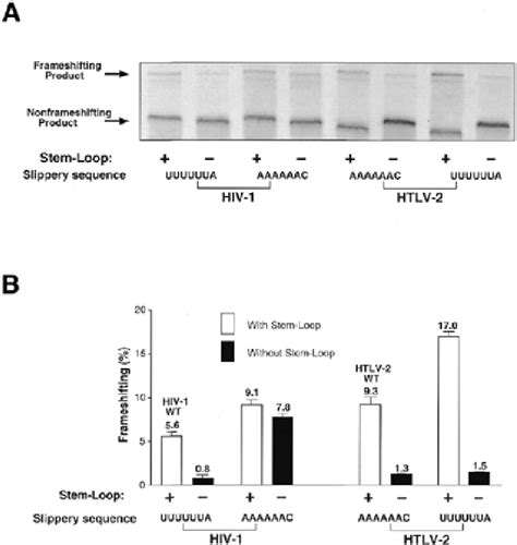 A Sds Page Analysis Of 35 S Methionine Labeled Translation Products