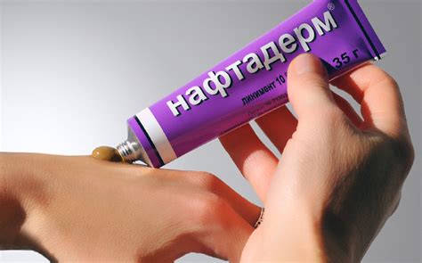 Нафтадерм – мазь с нафталанской нефтью