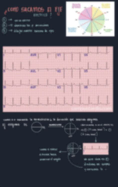 SOLUTION Electrocardiograma Studypool