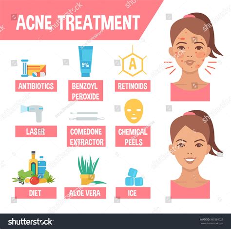 Acne Treatment Procedures Acne Infographic Elements Stock Illustration