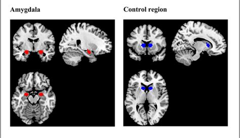 Figure 2 From Down Regulation Of Amygdala Activation With Real Time