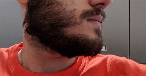 Beard Woes Album On Imgur