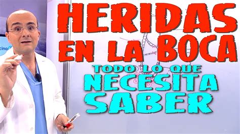 Guía completa Cómo curar una herida en la boca por dentro Sin