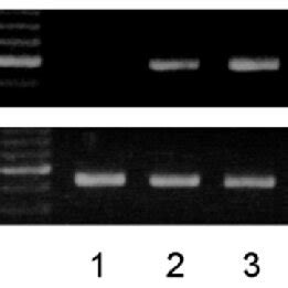 Rt Pcr Analysis Of Fibronectin Mrna Expression In Human Preimplantation