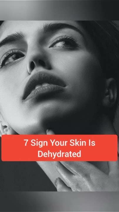 7 Sign Of Dehydrated Skin Skinissue Shorts Youtube