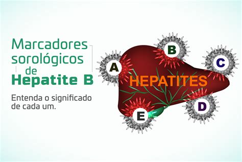 Marcadores De Hepatite B No Exame De Sangue Blog Biosseguran A