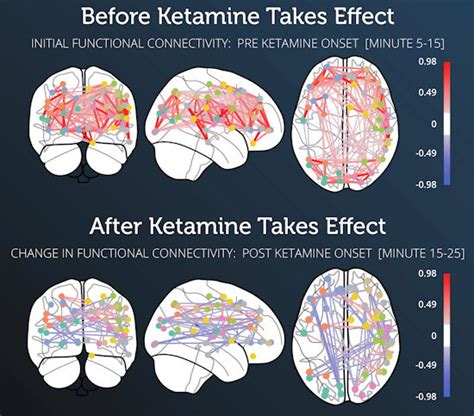 Cybin Kernel Tout Study Of Ketamine S Effects On Brain