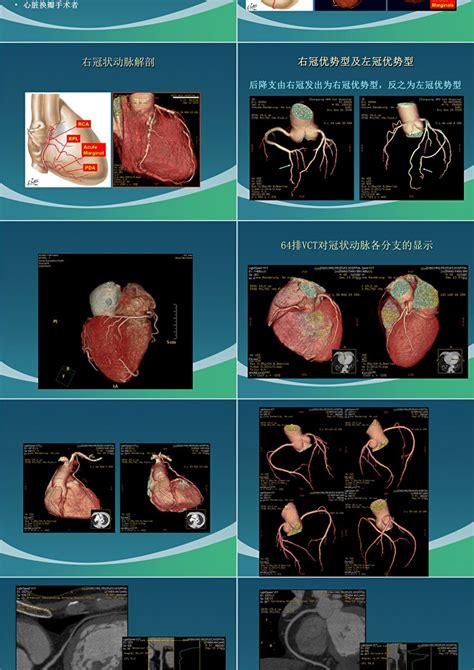 冠状动脉cta的临床应用ppt模板卡卡办公
