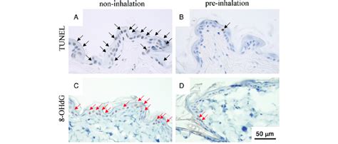 TUNEL And 8 OHdG Staining Of Skin Sections 24 H After 20 Gy