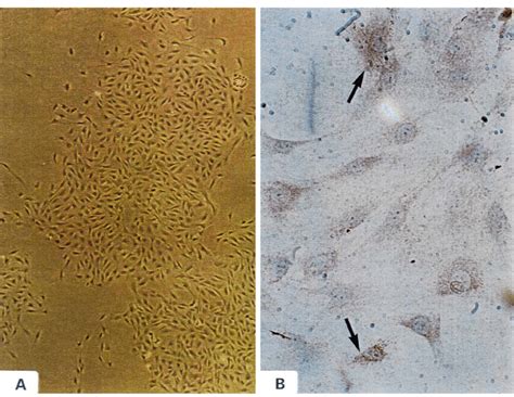 A Phase Contrast Photomicrograph Of Cultured Endothelial Cells Showing