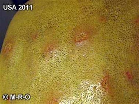 Morgellons skin lesions wounds eye infections