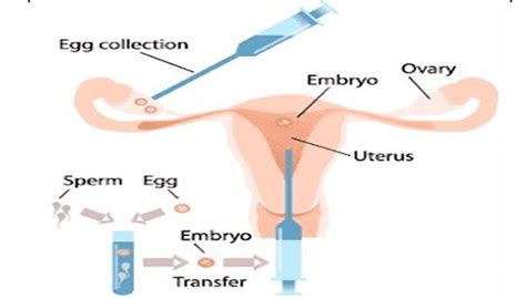 DIFFERENCES BETWEEN EGG DONATION AND EMBRYO DONATION 1 Rocky Mountain